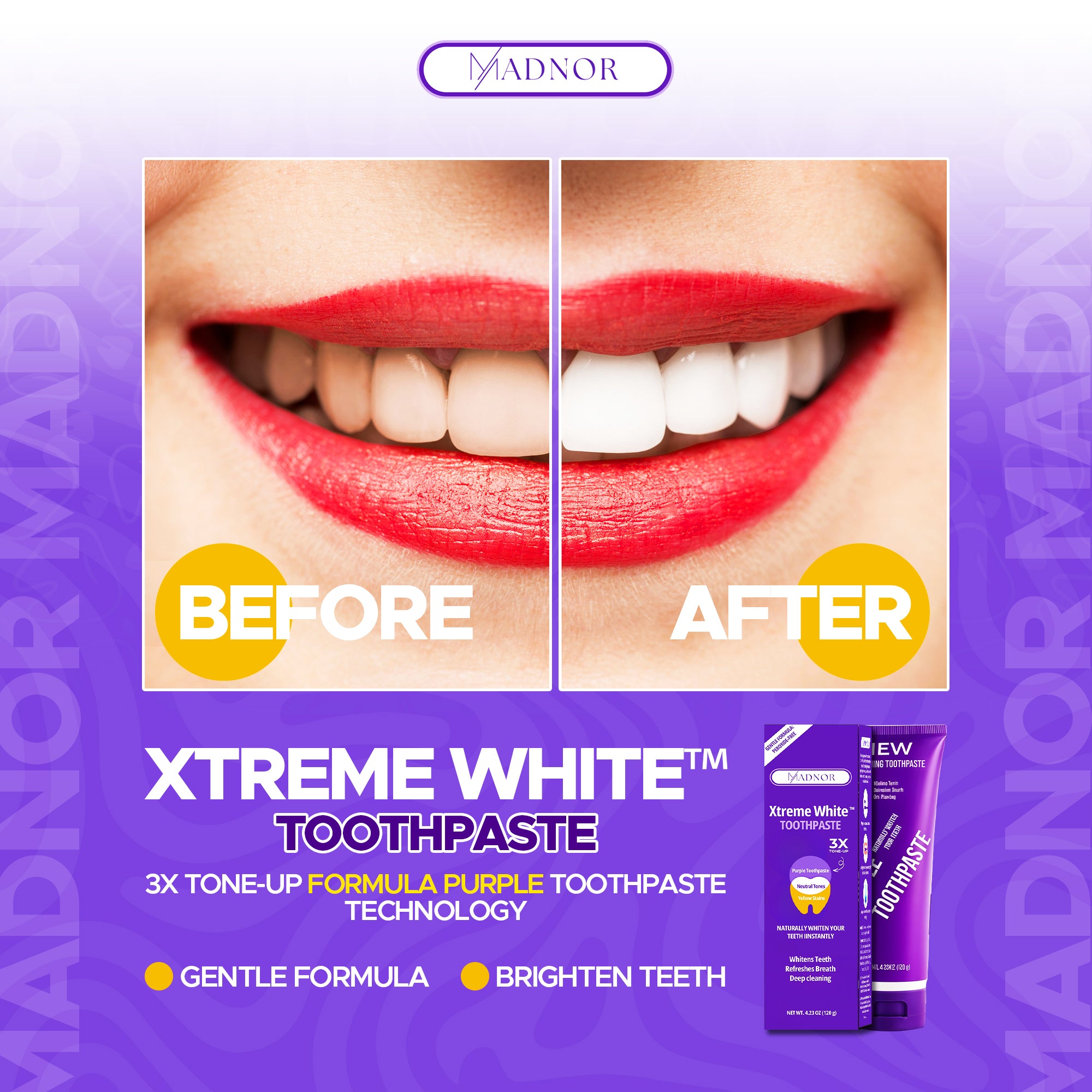 Xtrem White Whitening Toothpaste urple by Madnor